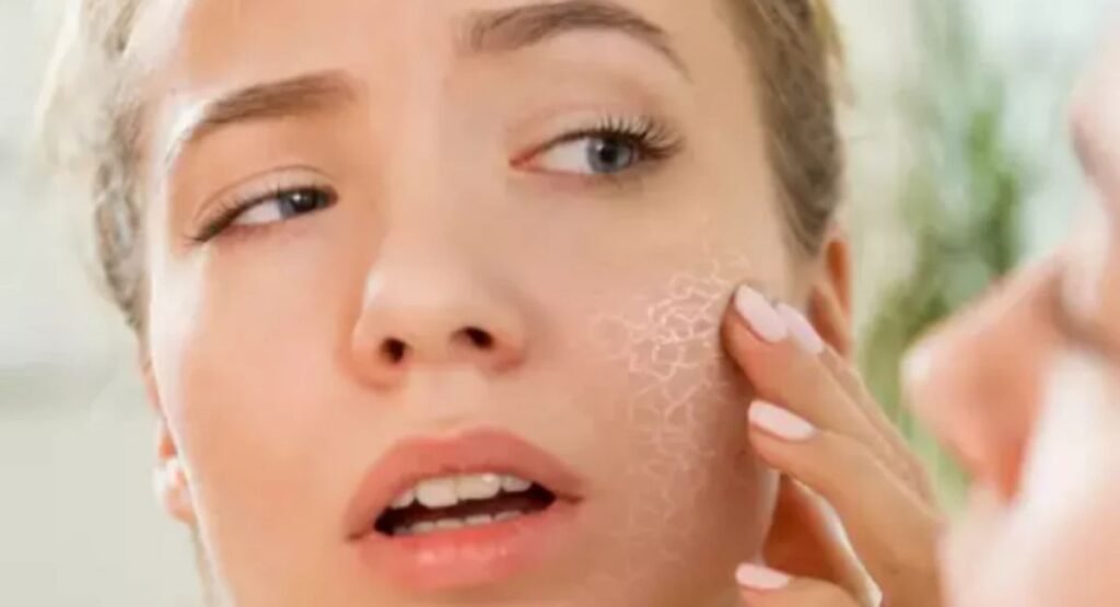 How to Get Rid of Dead Skin on Face: Easy Steps for Smooth Skin How to Get Rid of Dead Skin on Face