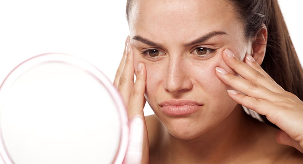 How to Get Rid of Dead Skin on Face