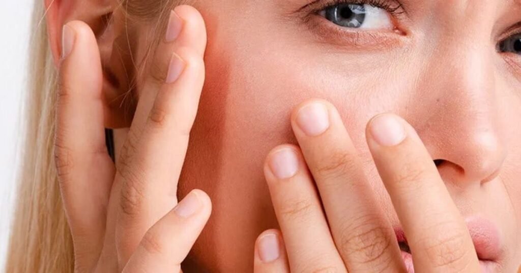 dry skin around eye area